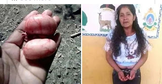 Wife Cuts Cheating Husband's Balls While Sleeping With A Lady - Crime -  Nigeria