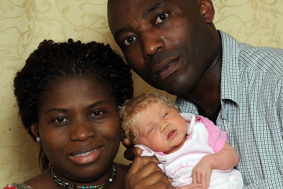 Remember The Nigerian Couple Who Gave Birth To A White, Blond Baby