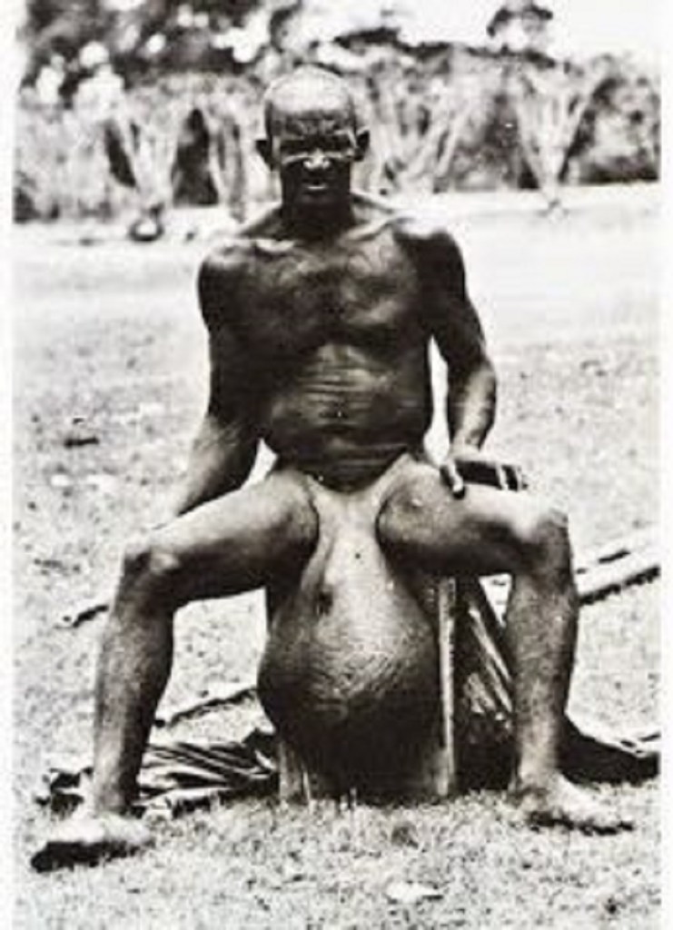 This African Tribe Has Giant Scrotum And They Sit On It Like A Pillow -  Culture - Nigeria