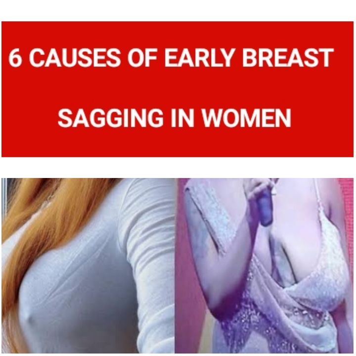 What Causes a Saggy Breast?