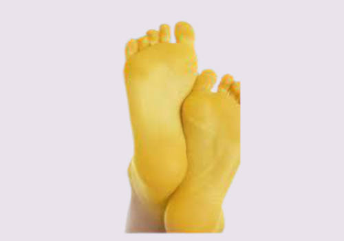 Bottom Of Feet Yellow What Does It Mean - Health - Nigeria