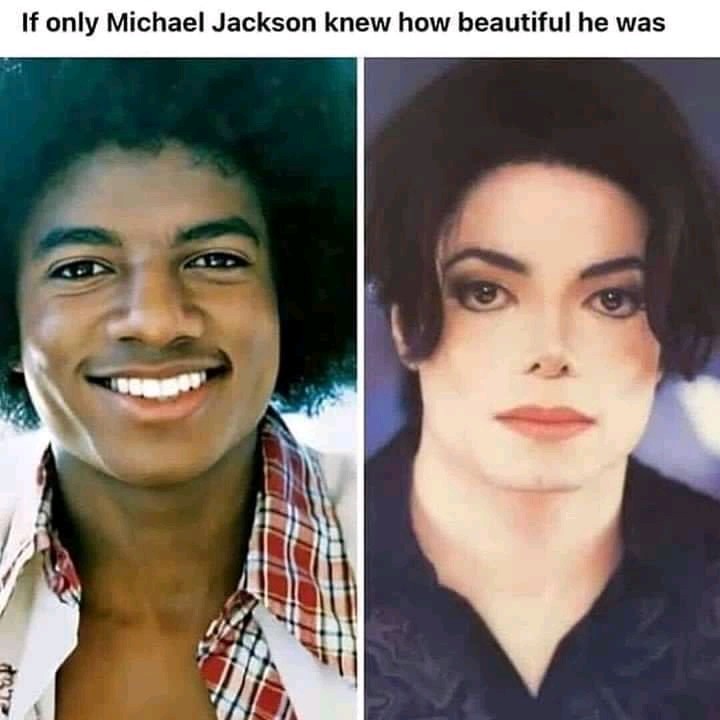 Plastic Surgery Michael Jackson