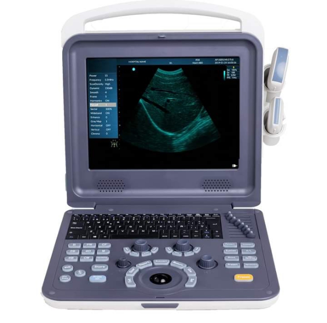 Ultrasound Scan Available For Sale In Lagos Nigeria Health Nigeria 9608