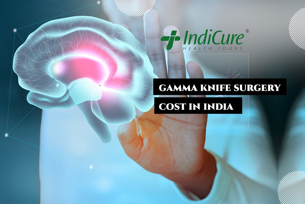 the-history-and-evolution-of-gamma-knife-surgery-cost-in-india-health