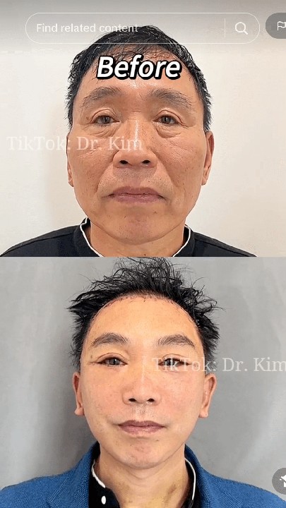 Tiktok Doctor Posts Before And After Pics With Horrifying Results