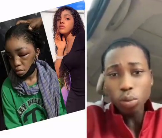 Lil Frosh Beats His Girlfriend, Thacutegeminne, Her Face Swollen -  Celebrities - Nigeria