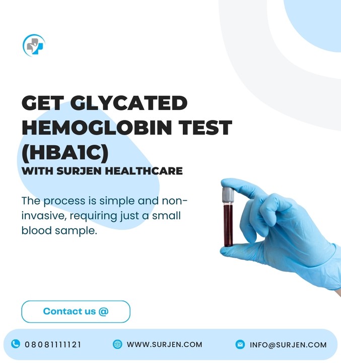 Glycated Hemoglobin Test (hba1c)(average Blood Sugar Test) - Health ...