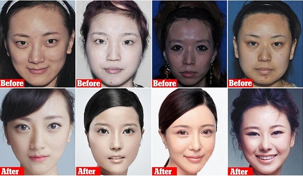 Photos: These Women Had Plastic Surgeries So Drastic They Couldn’t Get ...