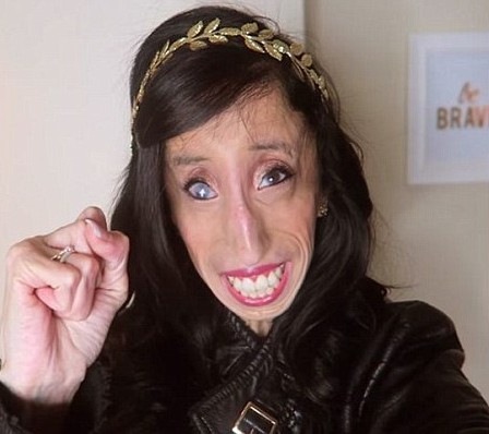 Woman Branded As The World #ugliest# Woman Fight Back In An ...