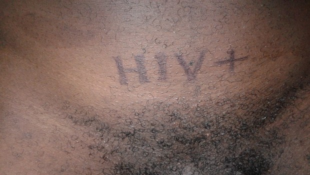 South Africa Passes Law To Mark HIV Infected People At Their Genitals