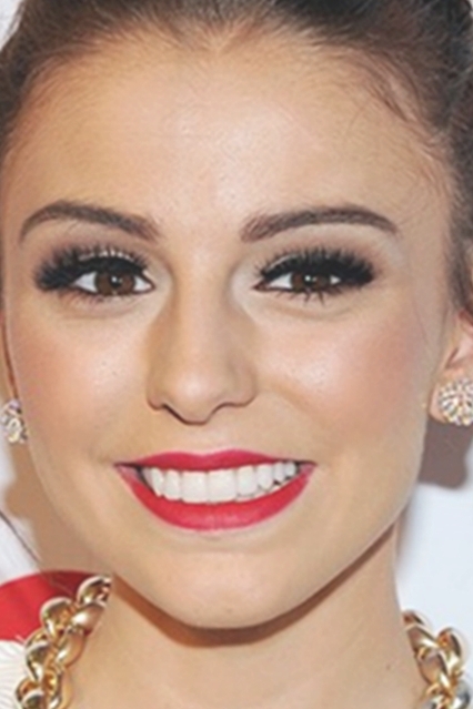 Cher Lloyd's Teeth HD Wallpapper, We Have More Than Different Wallpapers  For You - Celebrities - Nigeria