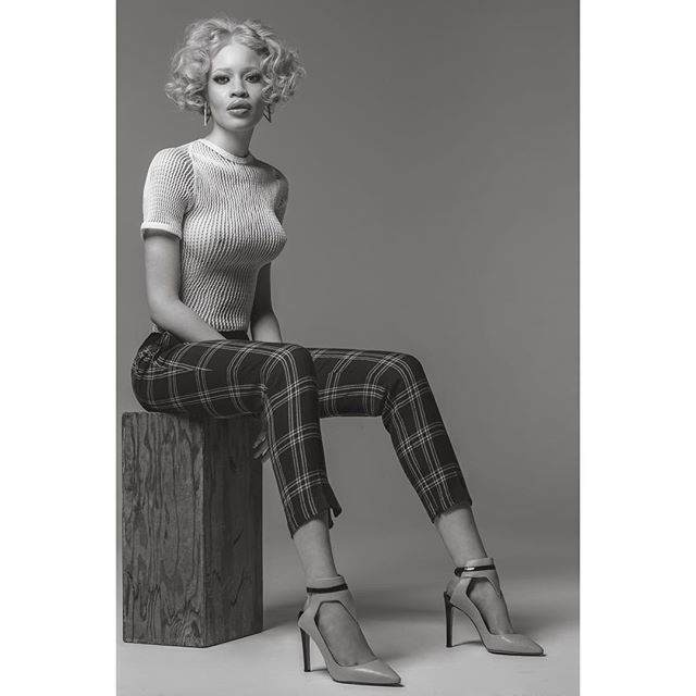 Sexy Pic Of American Albino Model, Diandra Forrest - Celebrities - Nigeria