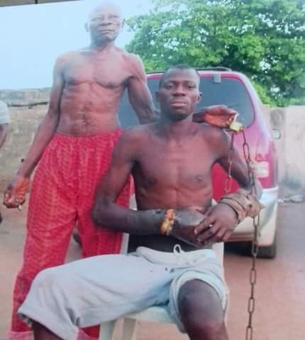 Graphic Pics: The Decaying Hand Of Man Chained By His Father For