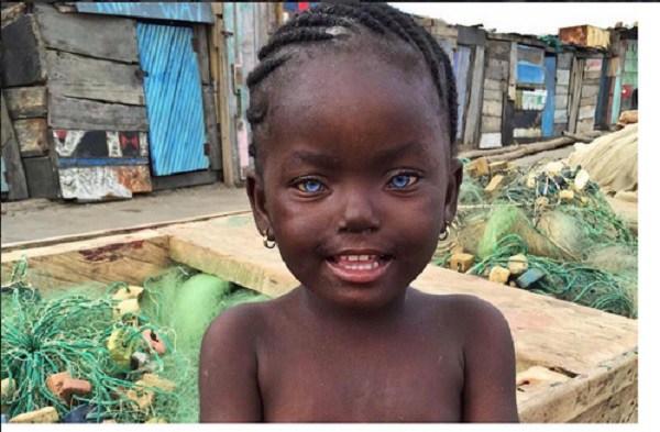 Little Ghanaian Girl Causes Division Online Over Origin Of Her Blue Eyes  (photos - Celebrities - Nigeria