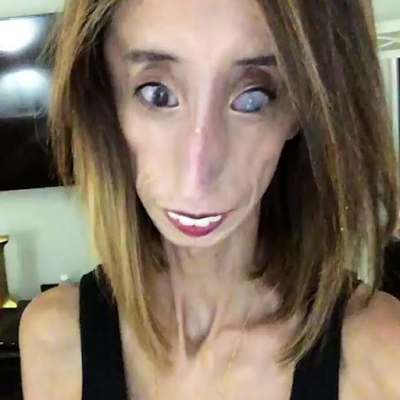 World's Ugliest Woman, Lizzie Velasquez Fighting Strongly In Different ...