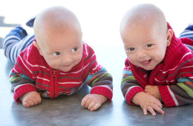 Mind Blowing Facts You Never Knew About Twins Health Nigeria