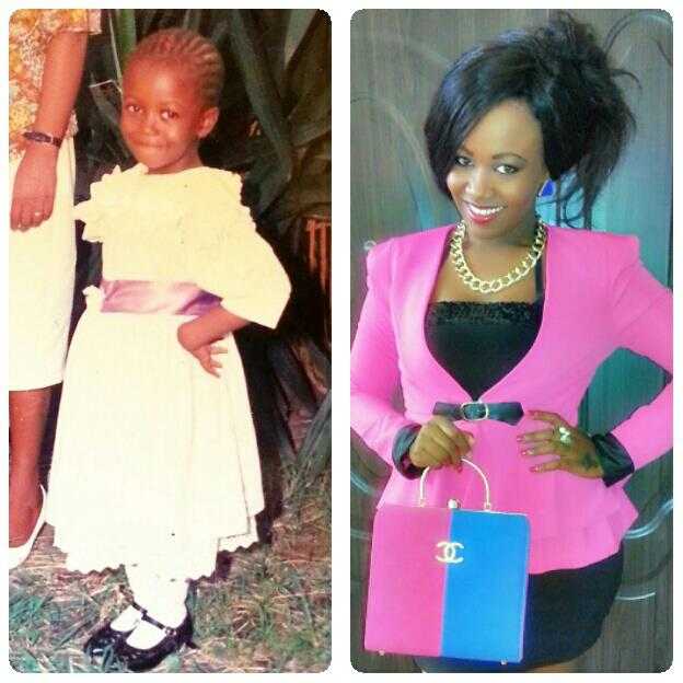 vera sidika bleaching before and after
