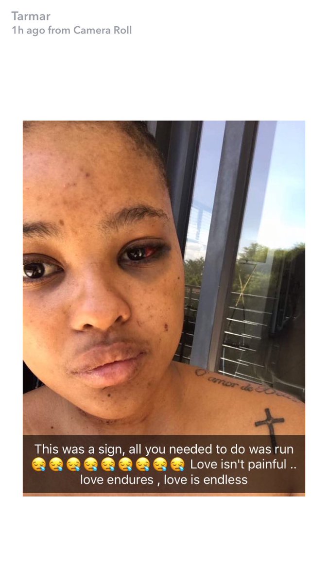 South African Man Who Burnt His Girlfriend Once Beat Her (Photos) - Crime -  Nigeria