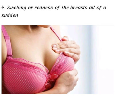 10 symptoms of breast cancer