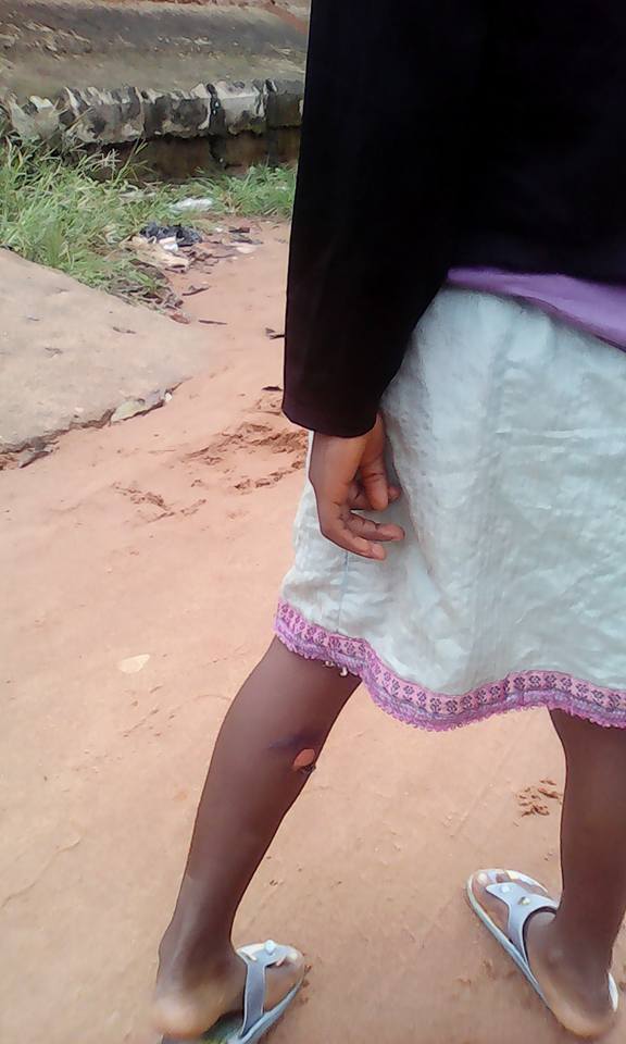 Woman Arrested In Anambra For Putting Pepper In A 7-year-old Girl's