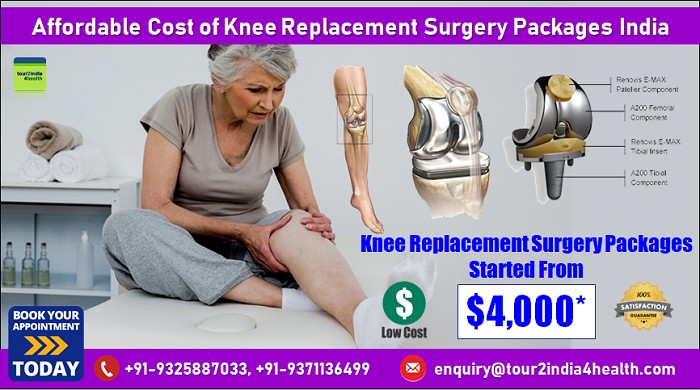 Affordable Knee Replacement Surgery For Nigerian Health