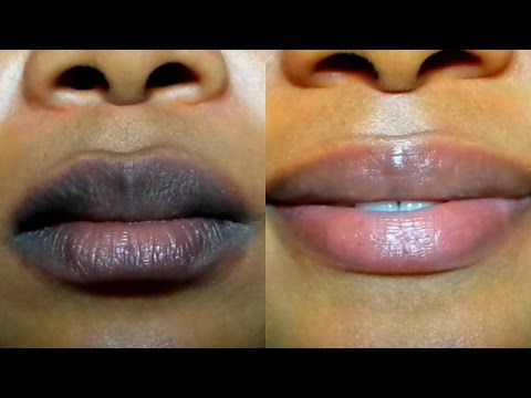 5 Ways To Get Rid Of Dark Lips - Health - Nigeria