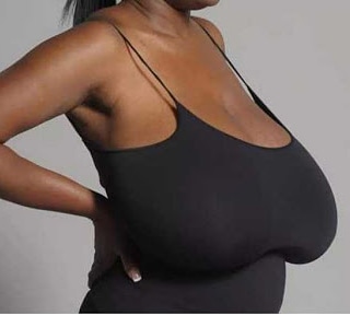 What Causes Saggy Breasts?
