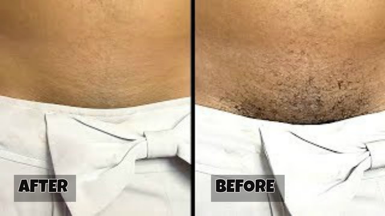 Stop Shaving Proper Way To Remove Pubic Hair Without Shaving Health Nigeria