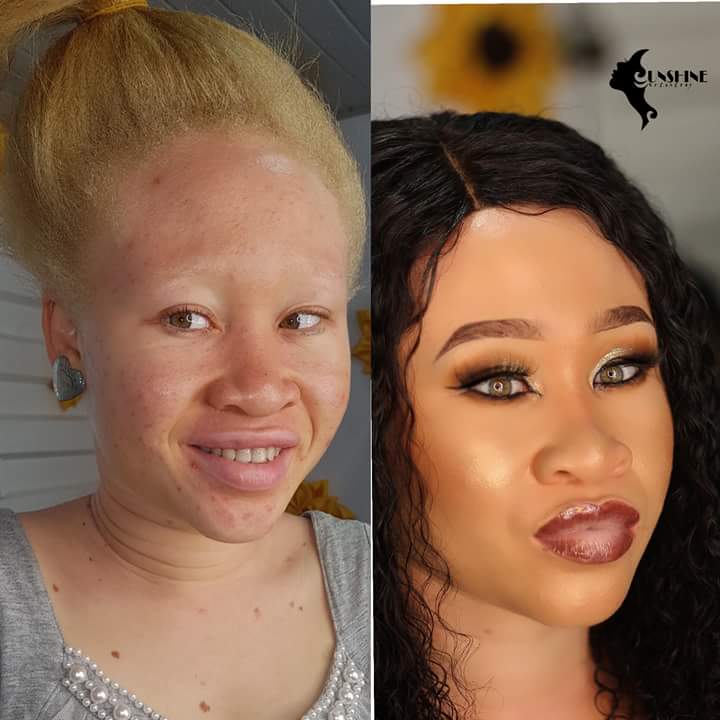 albino people with makeup