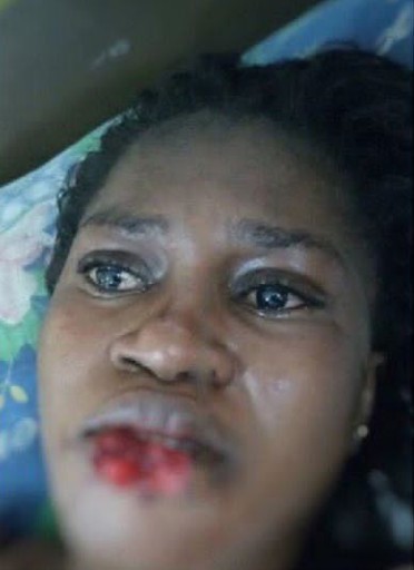 Girlfriend Bites Off The Lip Of A Lady Given A Lift By Her Boyfriend -  Crime - Nigeria