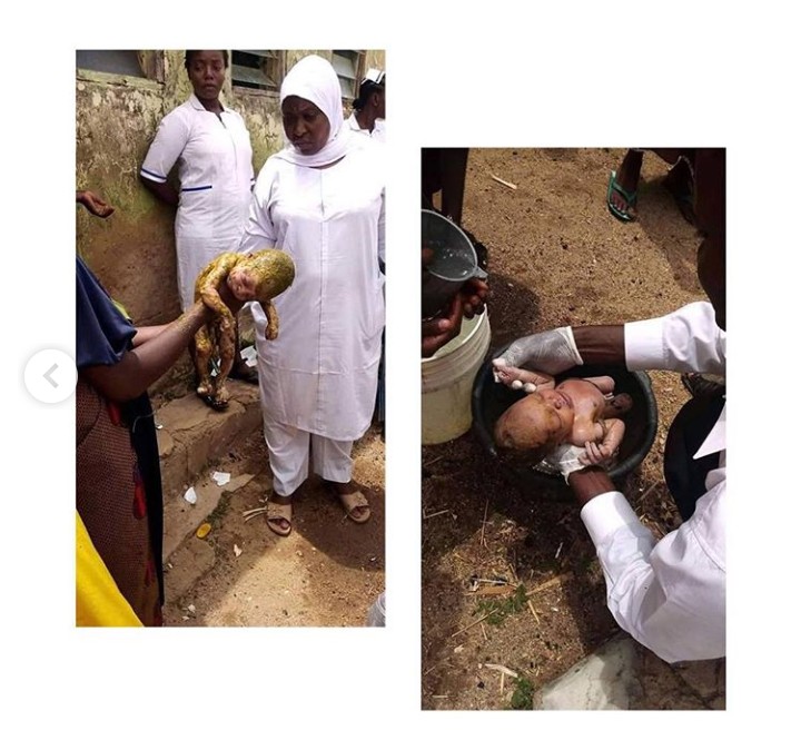 Newborn Baby Thrown Inside A Toilet, Rescued In Bauchi - Photos - Crime