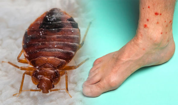 Danger Of Living In A Bed Bugs Infested Homes - Health  